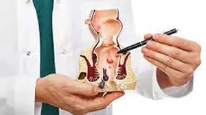 Advanced & Affordable Piles Surgery